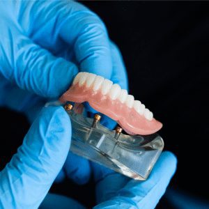 Dentures - care and cleaning
