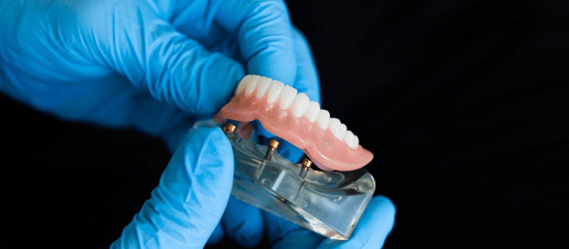 Dentures - care and cleaning