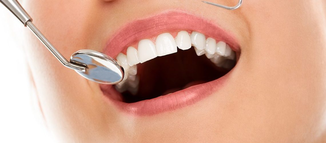 teeth whitening