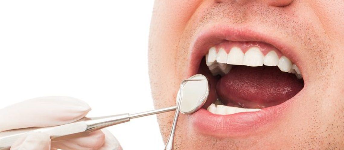 Porcelain Inlays and Onlays