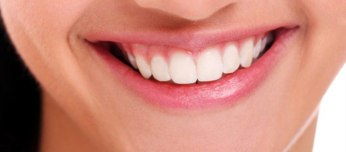 porcelain veneers